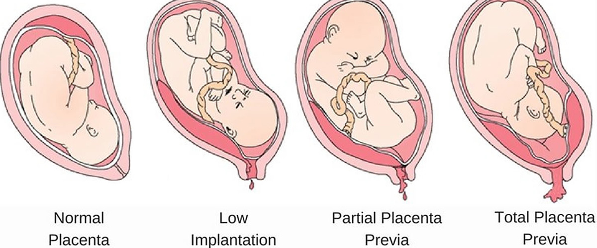 「プラセンタ」とはどういう意味？またどういうもの？英語で「placenta」と記述するとの事。