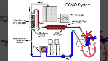 「エクモ」とはどういう意味？アルファベットで「ECMO」と記述するとの事。